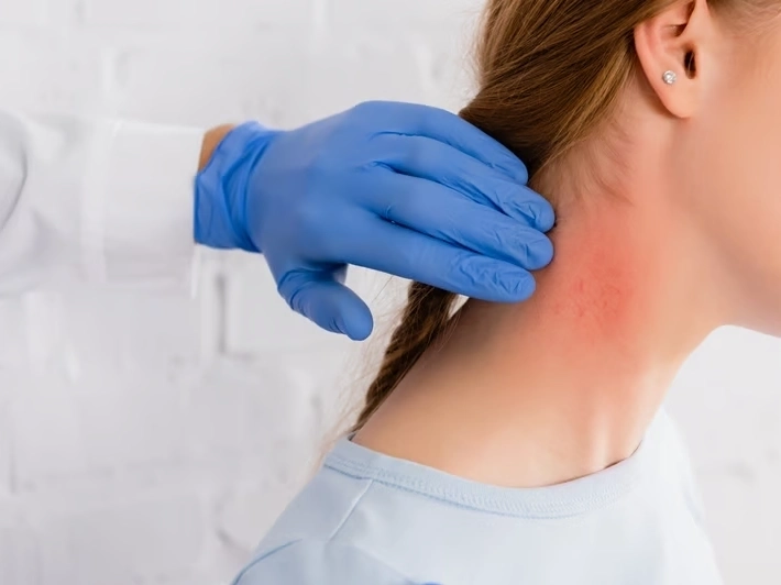 Neck Pain Relief service in Brentwood Estates